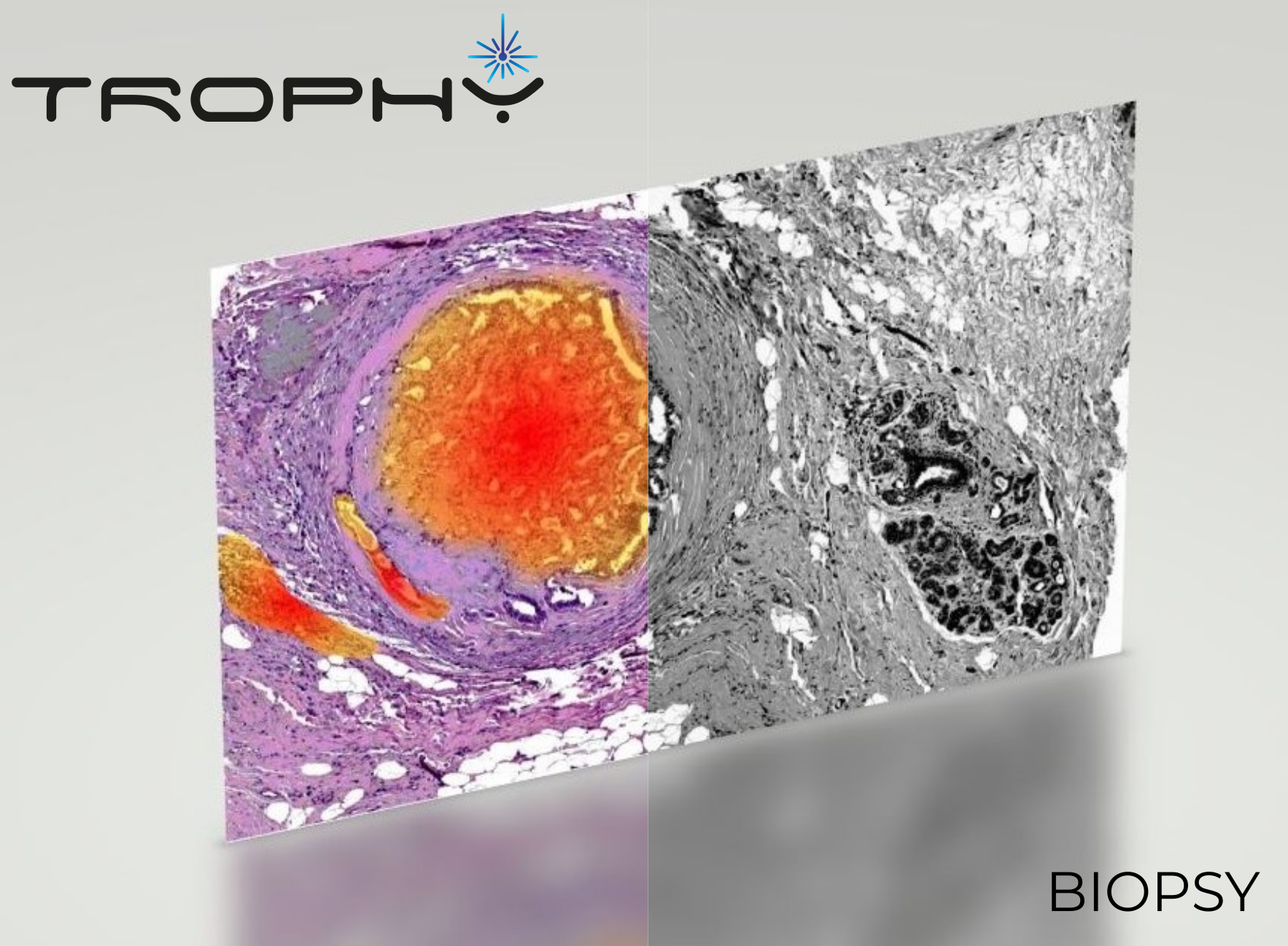 Ultrafast Microscopy TROPHY – ulTRafast hOlograPHic FTIR microscopY